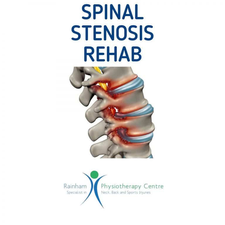 Do you suffer from spinal stenosis?!  Rainham Physio