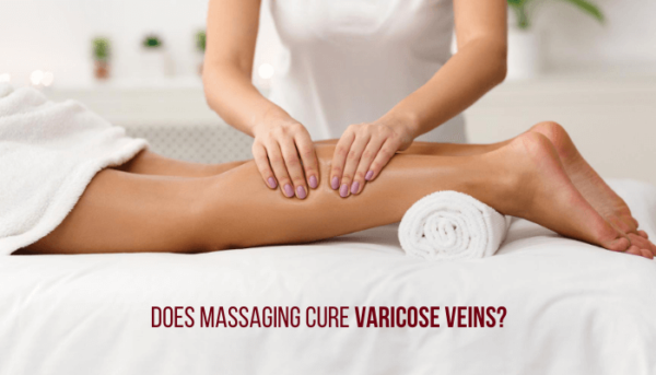 Does Massaging Cure Varicose Veins?