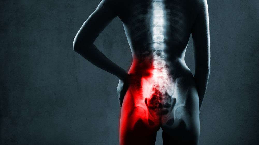 How to Relieve SI Joint Pain