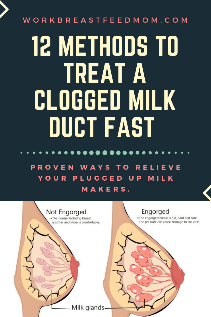 How to Treat a Clogged Milk Duct