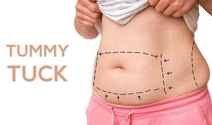 Lymphatic Massage After Tummy Tuck