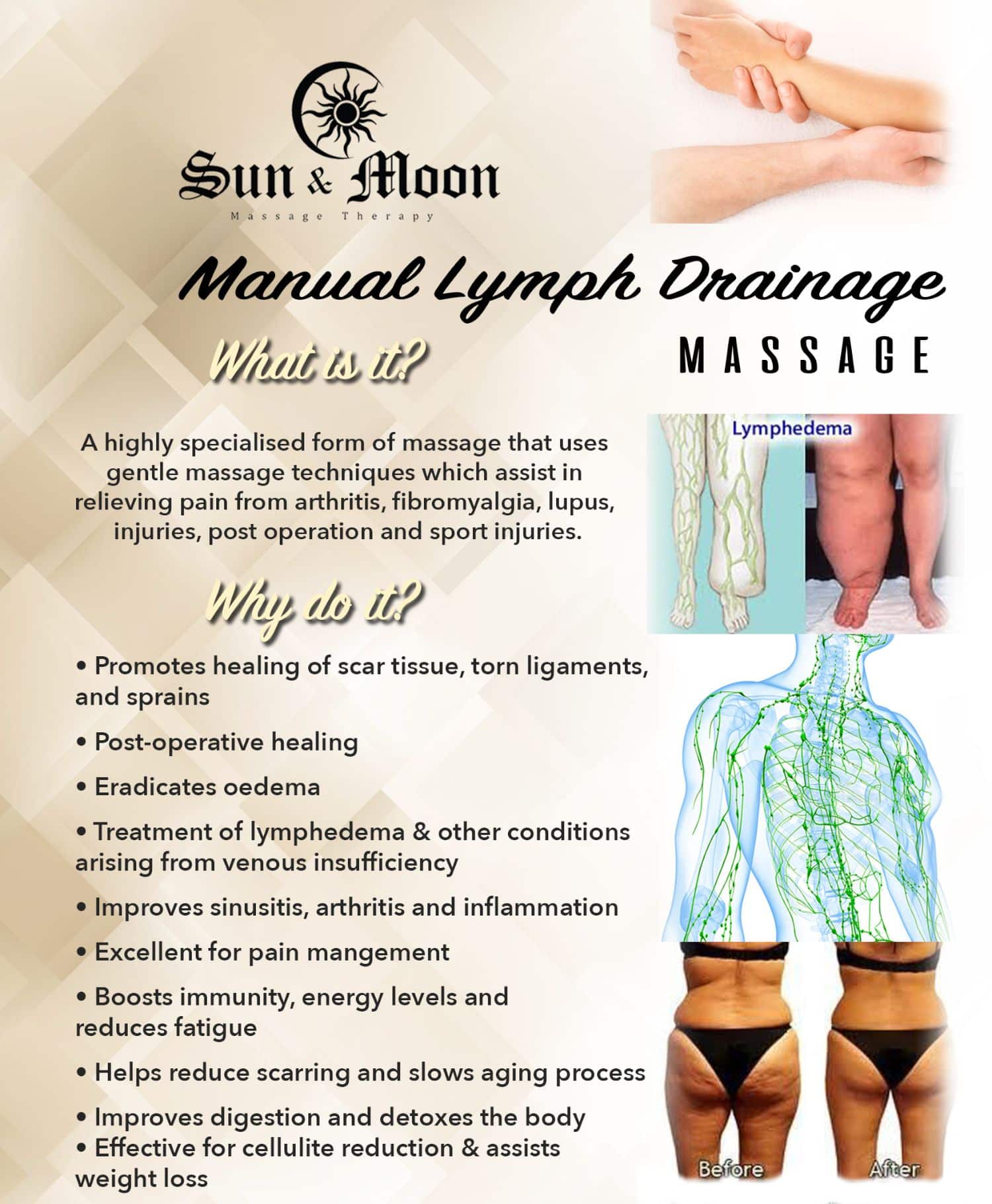 manual lymphatic drainage legs