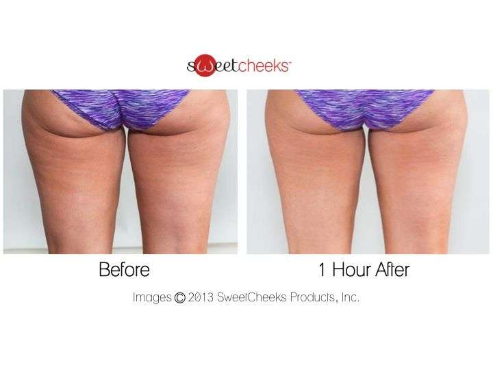 Pin on From Cellulite to SweetCheeks