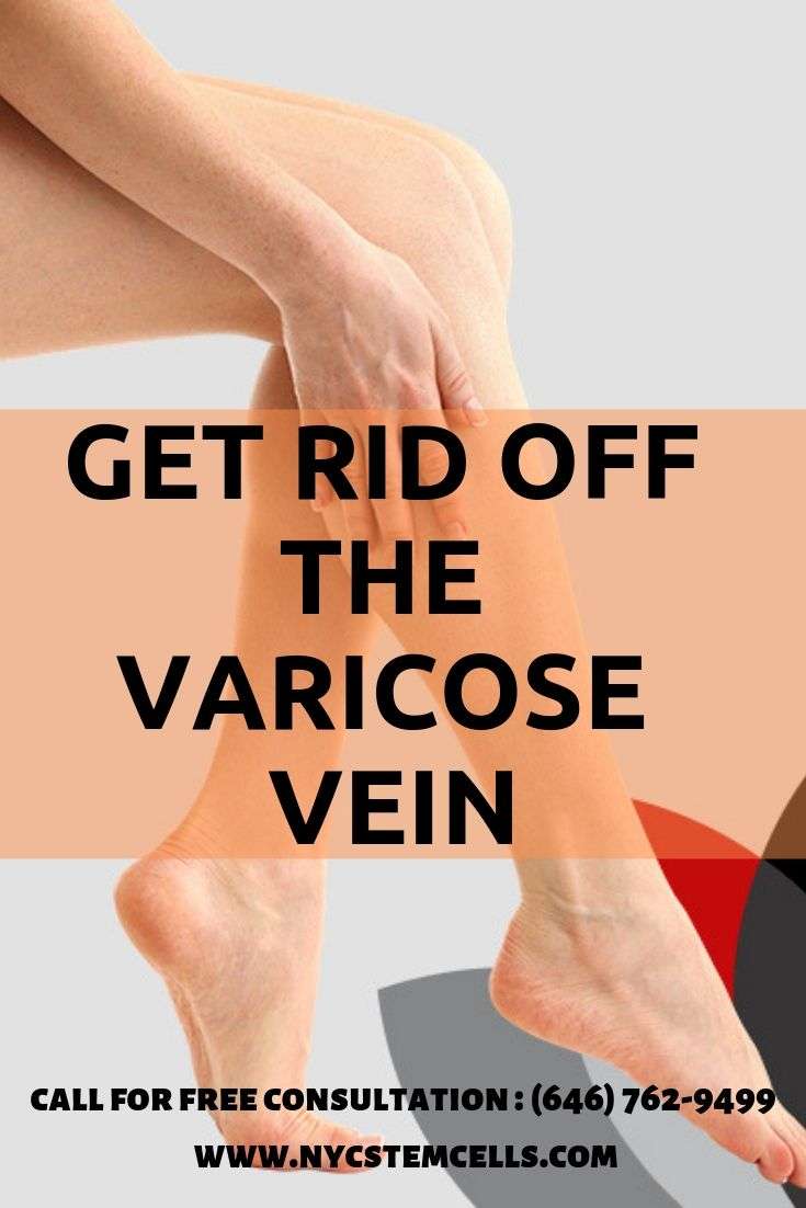 Pin on Varicose Veins Specialist NYC